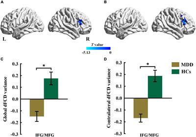 More Than Just Statics: Temporal Dynamic Changes in Inter- and Intrahemispheric Functional Connectivity in First-Episode, Drug-Naive Patients With Major Depressive Disorder